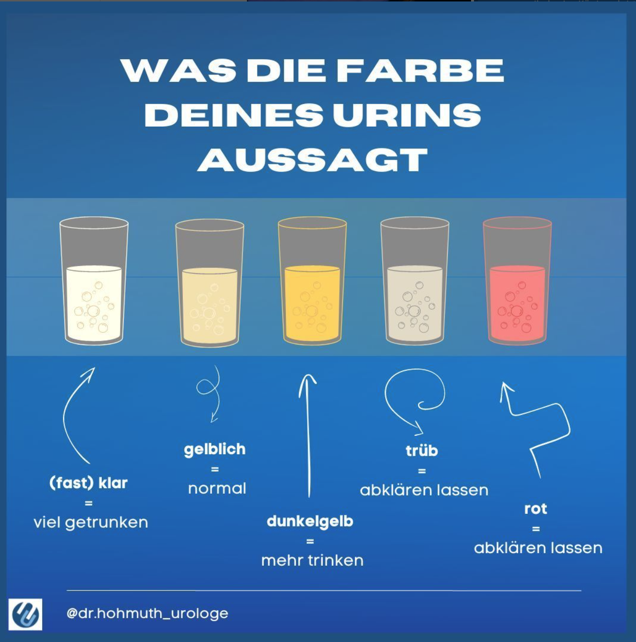 Die Farben des Urins